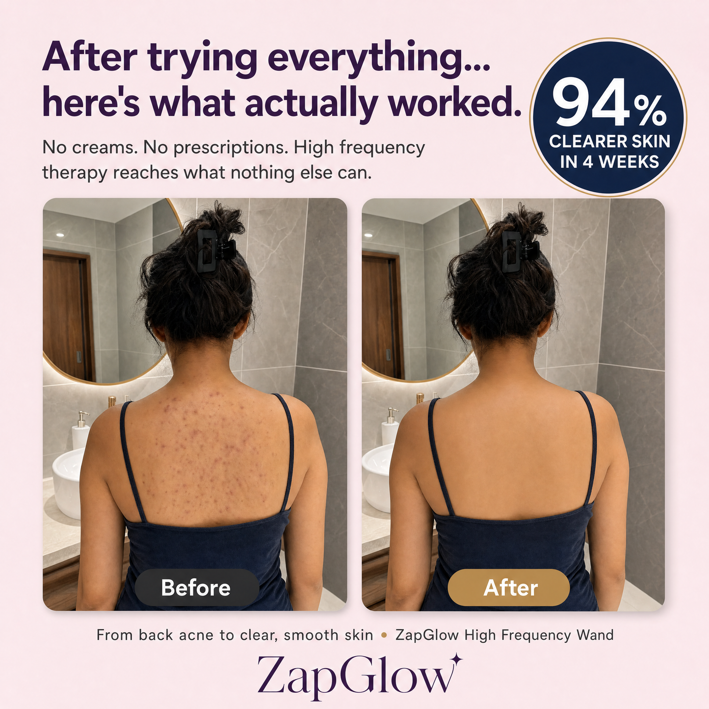 ZapGlow™